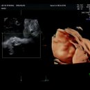 서울유산부인과의원 이미지