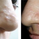 진성레이져 이미지