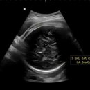 주차36 | [임신 후기] 36 ~ 37 주차 증상