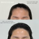 라인헤어 이미지