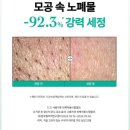 쑥달 | 내돈내산 모공 요철 관리 어린쑥 흡착 쑥떡 팩폼 한달 사용 재구매 후기 | 올영 수부지 민감성 트러블성...