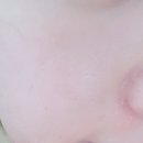 펩티너스