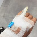 이두메디칼 | [어깨통증]회전근개파열 수술 후기 2_ 수술전 입원준비 및 병원검사(준비물, 금식)