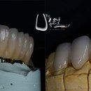 도담치과기공소 이미지