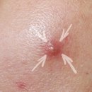 채피부과의원 이미지