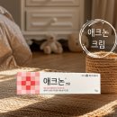 123약국 | 여드름 뾰루지 화농성 트러블 연고 추천 사용후기 : 애크논 크림