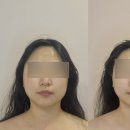 에스테틱페브