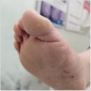 포쉬네일안산고잔점 | 고잔동발각질 엄선해서 찾아간 곳 포쉬네일 풀리메디 안산점