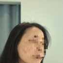 셀린의원 | 50대 예민한 피부 진정효과 ldm 강남역 피부과 셀린의원