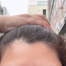 김헤어라인 | 청라왁싱 모미왁싱 헤어라인 왁싱받은 후기