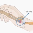 오륙도신경외과의원 네이버블로그