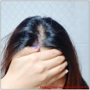 지성두피샴푸 테라피션 헤어토닉 헤어미스트로 두피관리