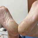 푸스케어 롯데마트제천점 네이버블로그
