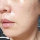 인셀덤티나