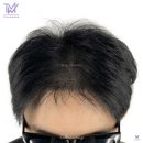 탈모왕 광주점 이미지