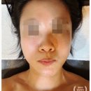 풍동피부맛집 허니에스테틱 고주파리프팅 전문관리로 탄력업 동안얼굴 후기