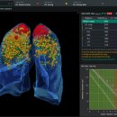 코어소프트 이미지