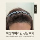 모플러스성형외과의원 | 서울 여성헤어라인교정 모발이식 상담 3곳 솔직후기(압구정·신사역 중심)