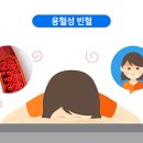 아양콩 이미지