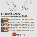 태형수지 이미지
