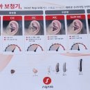 가가의료기 | 밀양보청기 귓속형, 오픈형, 귀걸이형 보청기 종류 구분법!