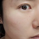 준메디케어 이미지