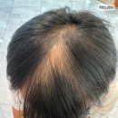 안양 두피 커버 브로우 기프트 안양점 체험 후기