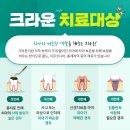 서귀포치과기공소 네이버블로그