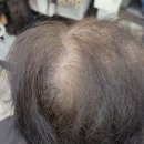 야누스 | 💇‍♀️ 대전가발 자연스러운 스타일에 만족한 야누스가발 후기