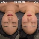 수정피부관리샵 | 파주 운정 윤곽 피부관리 전문샵 본아에스테틱 솔직 방문 후기