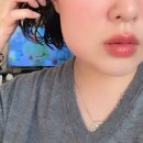 궁치과병원 | 아기천송이의 한국 여행기