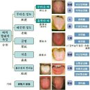 혀로 건강 체크하는방법 이미지