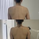 비오스 | 포항 양덕 피부관리, 비오스 스킨앤바디 뉴로 넥 테라피 후기