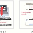 [비뇨기과] 발기부전 검사의 중요성 이미지