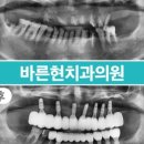 바른현치과의원 이미지