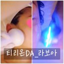 보아 | 가락동피부관리 티리온DA 라보아 케어 후기