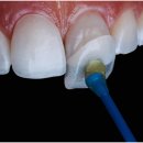 미백세탁소 이미지