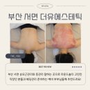 뷰티더유 | 부산 서면 승모근관리와 등관리 잘하는 곳 | 더유에스테틱