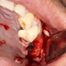 싸이너스 이미지