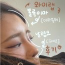 와이랩 | 09 : 민무늬 옆태탈출 입체적인 옆모습 만들기 ! ‘와이랩 부평’ 이마필러,하이코+필러 후기