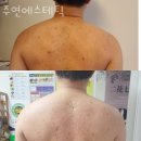 청담동피부관리 주연에스테틱 위치.가격.시간.후기