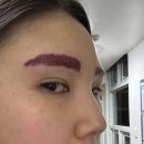 D-3 | 부산 눈썹문신제거 레이저 1회차 내돈내산 후기 (당일 ~ D+3)