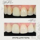 서울예봄치과 이미지