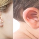 덕하보청기 이미지