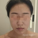 The 빛날 에스테틱 | 왕십리 피부관리 더작 왕십리점 더작윤곽관리로 오목조목 작은얼굴 만들기