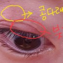 안동삼성연합안과의원 네이버블로그
