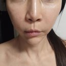 광고보고사본 디바샷 통증 효과 리얼후기