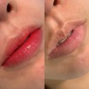 안양 범계 평촌 입술문신 전문샵 인레브