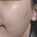 물광주사가 필요없는 수부지 깐달걀 피부템 &lt;에센시엘 하이드라 포르테 앰플&gt; 후기