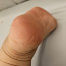 이로운동물병원 | [동탄 발각질관리] 레푸스 동탄호수점, 갈라진 뒤꿈치에서 아기발로 환골탈태한 솔직 후기!